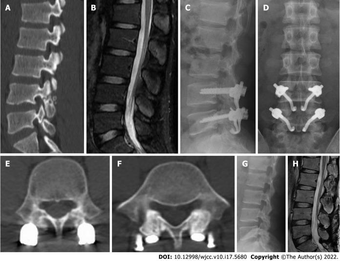 https://cdn.ncbi.nlm.nih.gov/pmc/blobs/6993/9258354/c29ccc0291ef/WJCC-10-5680-g004.jpg