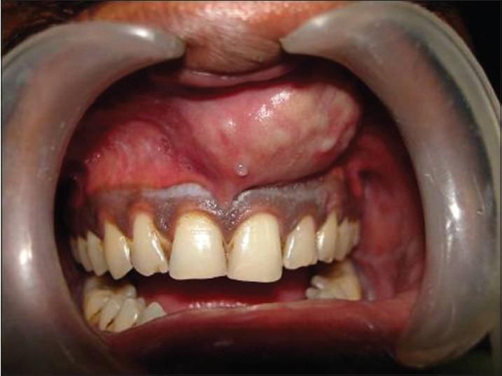 https://cdn.ncbi.nlm.nih.gov/pmc/blobs/6996/4181138/435102b30dec/IJABMR-4-61-g002.jpg