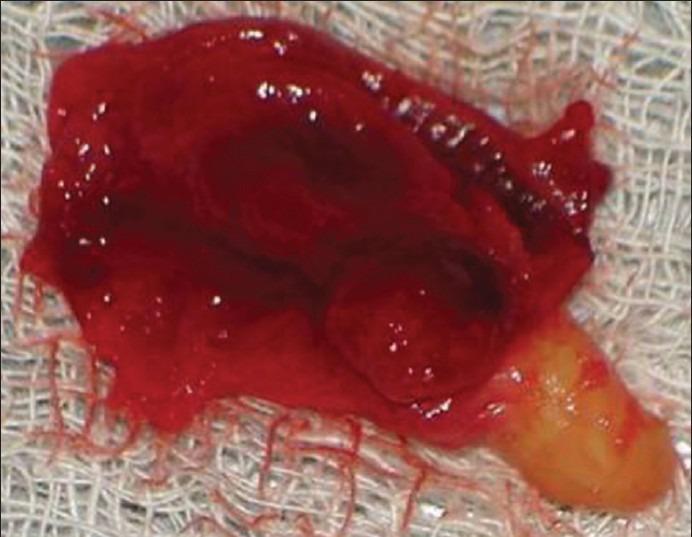 https://cdn.ncbi.nlm.nih.gov/pmc/blobs/6996/4181138/780882d75b99/IJABMR-4-61-g006.jpg