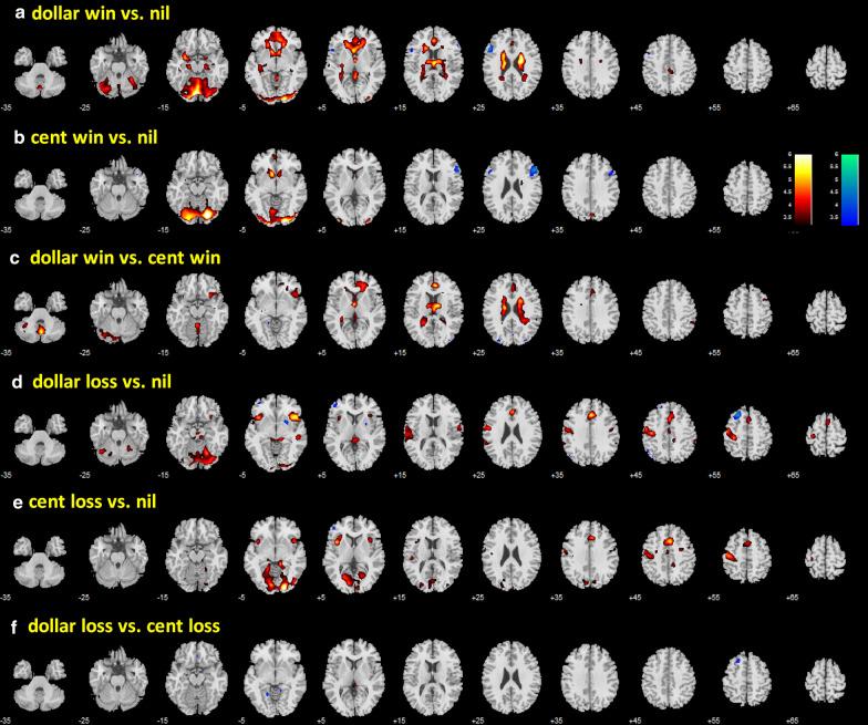 https://cdn.ncbi.nlm.nih.gov/pmc/blobs/6997/7913329/3ffe2122f5ad/12868_2021_618_Fig4_HTML.jpg