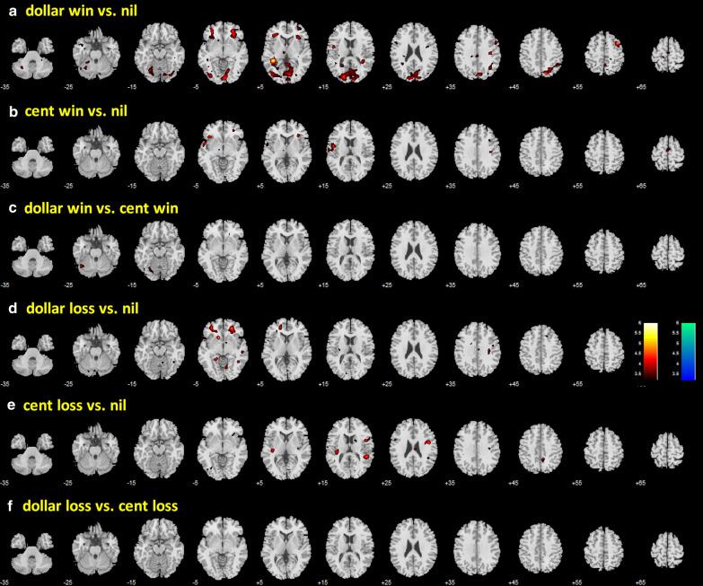 https://cdn.ncbi.nlm.nih.gov/pmc/blobs/6997/7913329/63a05d71392e/12868_2021_618_Fig5_HTML.jpg