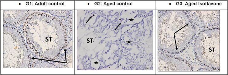 https://cdn.ncbi.nlm.nih.gov/pmc/blobs/699b/9442360/9bb7a3d0913e/gr4.jpg
