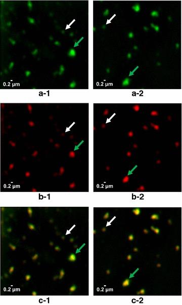 https://cdn.ncbi.nlm.nih.gov/pmc/blobs/699c/5798182/0a7e999f19f9/12934_2018_868_Fig9_HTML.jpg