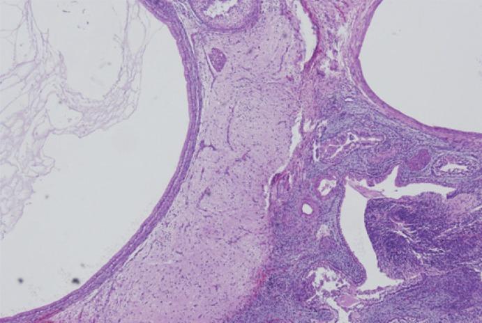 https://cdn.ncbi.nlm.nih.gov/pmc/blobs/699e/4230561/1ecbddca7ceb/rado-48-04-397f4.jpg