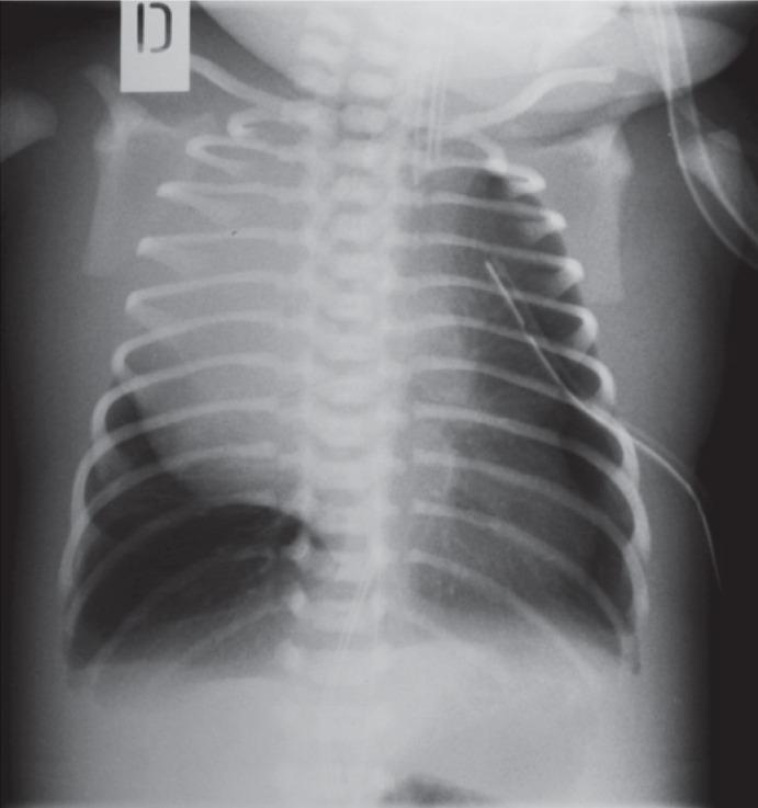 https://cdn.ncbi.nlm.nih.gov/pmc/blobs/699e/4230561/23c3ce2a1110/rado-48-04-397f2.jpg