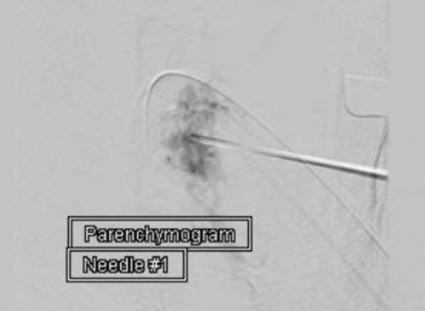 https://cdn.ncbi.nlm.nih.gov/pmc/blobs/69a5/7053799/0d2e42d4cc95/cureus-0008-00000000483-i03.jpg