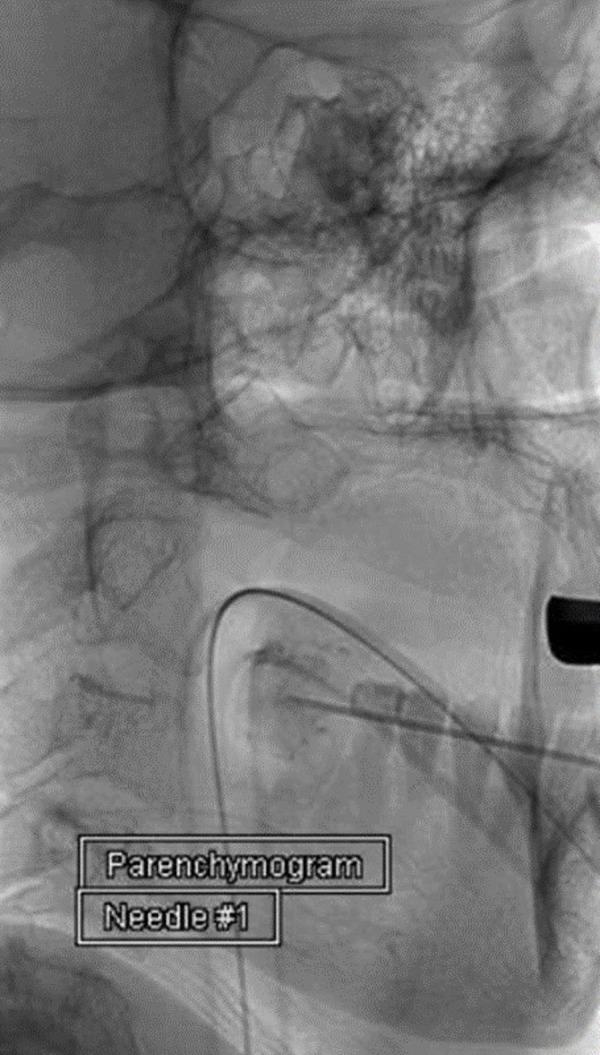 https://cdn.ncbi.nlm.nih.gov/pmc/blobs/69a5/7053799/e005f1bbc88c/cureus-0008-00000000483-i02.jpg