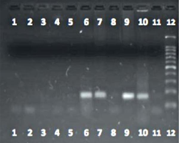 https://cdn.ncbi.nlm.nih.gov/pmc/blobs/69a6/4155947/1f1dff03a68f/abd-89-05-0701-g11.jpg