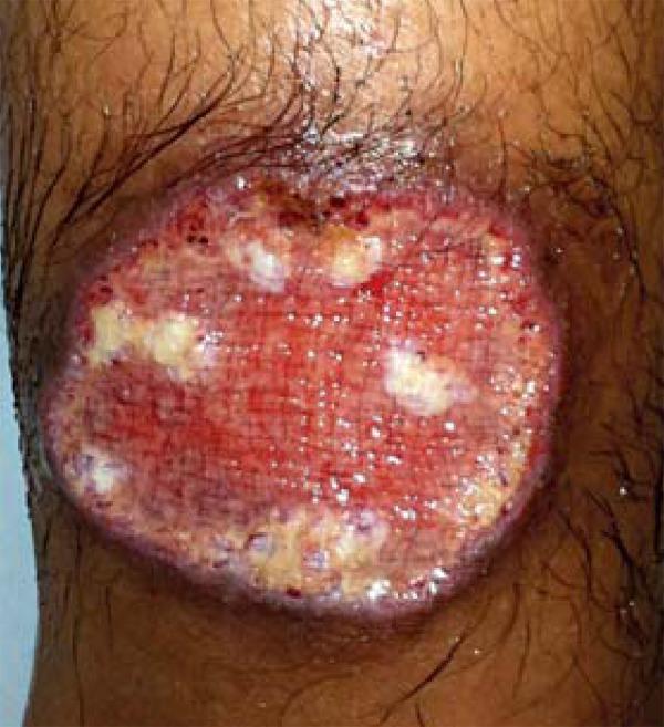 https://cdn.ncbi.nlm.nih.gov/pmc/blobs/69a6/4155947/22b4d8297409/abd-89-05-0701-g02.jpg