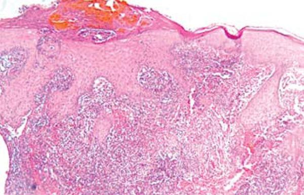 https://cdn.ncbi.nlm.nih.gov/pmc/blobs/69a6/4155947/4fd534ff172f/abd-89-05-0701-g07.jpg