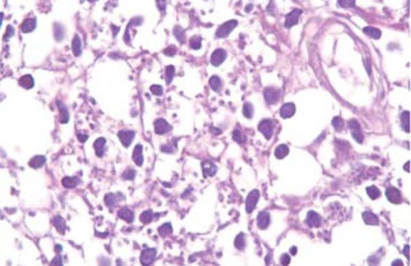 https://cdn.ncbi.nlm.nih.gov/pmc/blobs/69a6/4155947/617041079515/abd-89-05-0701-g06.jpg