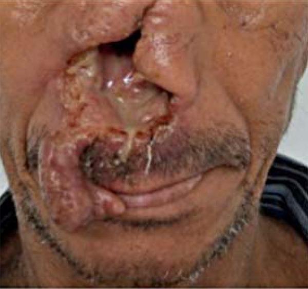 https://cdn.ncbi.nlm.nih.gov/pmc/blobs/69a6/4155947/865665ad1ed8/abd-89-05-0701-g03.jpg