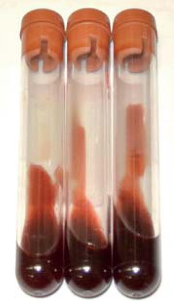 https://cdn.ncbi.nlm.nih.gov/pmc/blobs/69a6/4155947/8964d4bb38be/abd-89-05-0701-g08.jpg