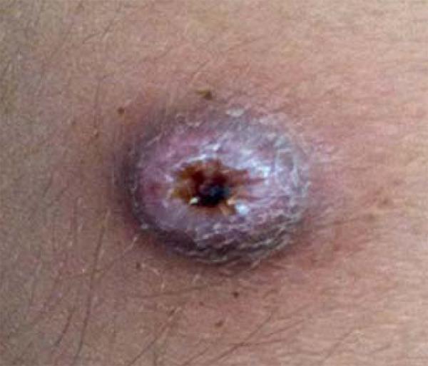 https://cdn.ncbi.nlm.nih.gov/pmc/blobs/69a6/4155947/95b64f074a83/abd-89-05-0701-g01.jpg