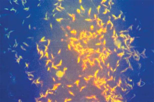 https://cdn.ncbi.nlm.nih.gov/pmc/blobs/69a6/4155947/eb2281a85906/abd-89-05-0701-g05.jpg
