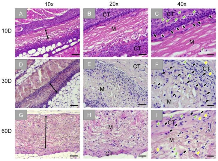 https://cdn.ncbi.nlm.nih.gov/pmc/blobs/69a6/8467533/e171d1667410/membranes-11-00712-g004.jpg
