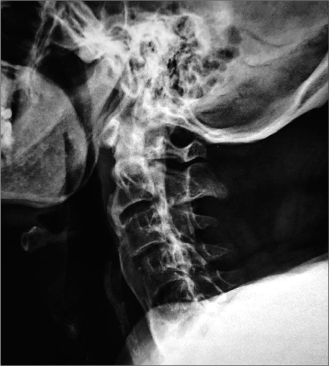 https://cdn.ncbi.nlm.nih.gov/pmc/blobs/69ad/9062959/6c5b7ecfe95a/SNI-13-158-g001.jpg