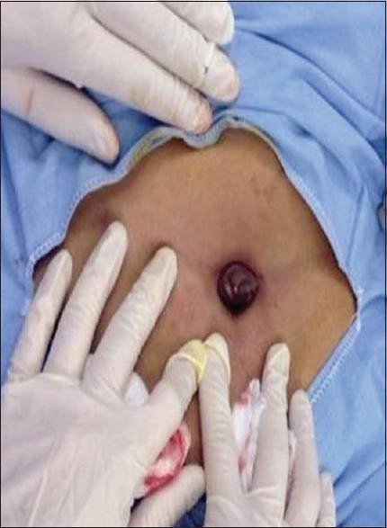 https://cdn.ncbi.nlm.nih.gov/pmc/blobs/69b2/6298282/682d2fac0920/SJMMS-5-74-g001.jpg