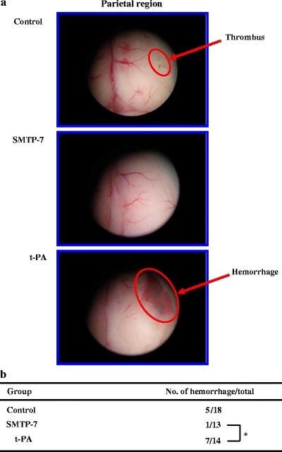 https://cdn.ncbi.nlm.nih.gov/pmc/blobs/69b4/2926440/176e408f414c/210_2010_542_Fig4_HTML.jpg
