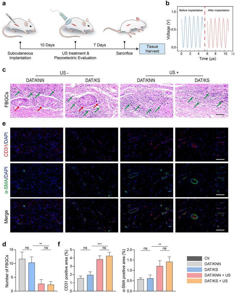 https://cdn.ncbi.nlm.nih.gov/pmc/blobs/69be/12279238/18a05c3b9b96/ADVS-12-2504293-g004.jpg