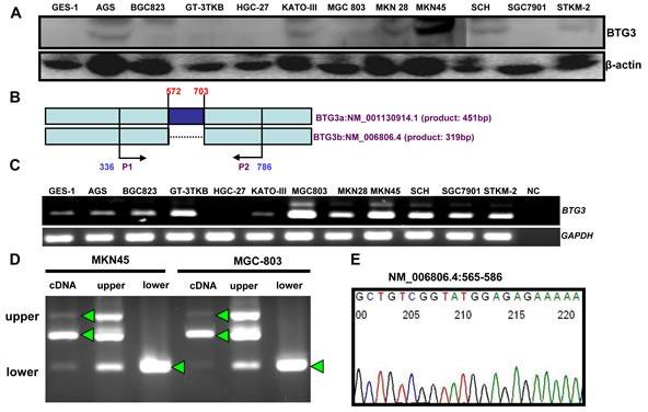 https://cdn.ncbi.nlm.nih.gov/pmc/blobs/69c0/4637325/4e6d6557f19c/oncotarget-06-19841-g001a.jpg