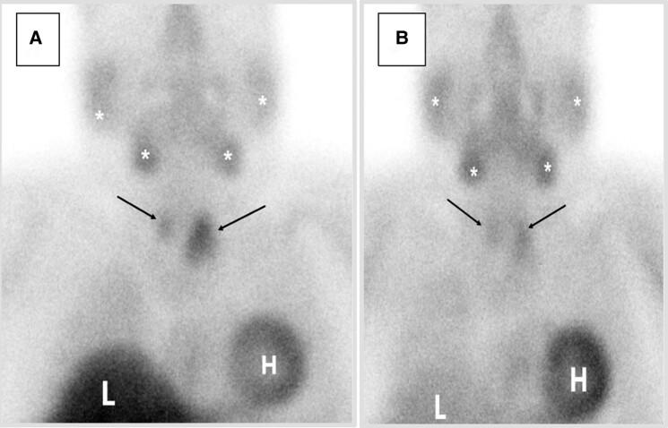 https://cdn.ncbi.nlm.nih.gov/pmc/blobs/69c1/10768879/b3c9e3da8484/luad173f2.jpg