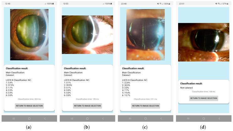 https://cdn.ncbi.nlm.nih.gov/pmc/blobs/69c4/12252290/1e8fd534bae5/sensors-25-03954-g011.jpg