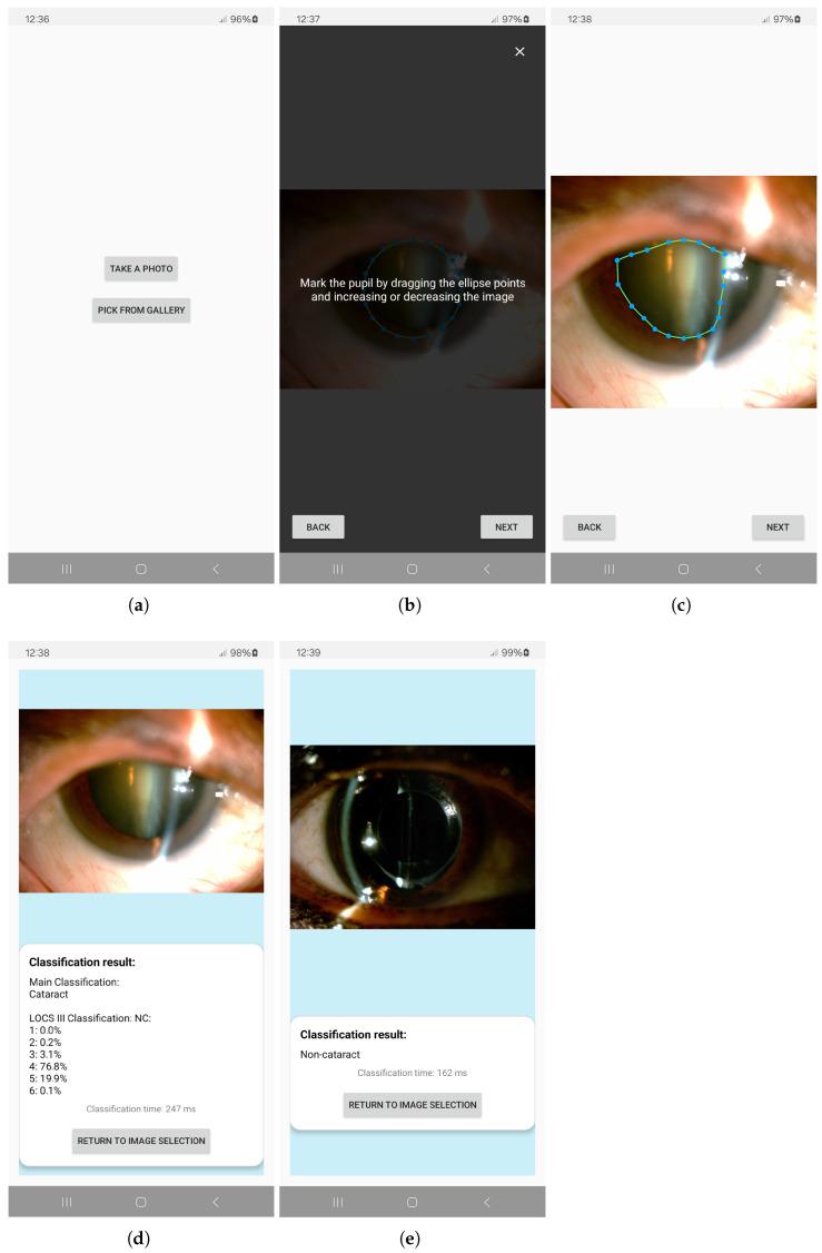 https://cdn.ncbi.nlm.nih.gov/pmc/blobs/69c4/12252290/3004a8121570/sensors-25-03954-g004.jpg