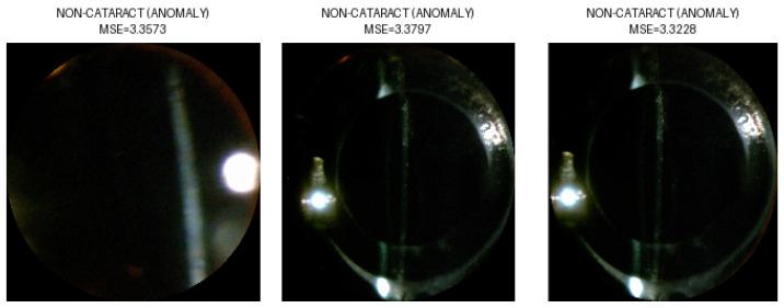 https://cdn.ncbi.nlm.nih.gov/pmc/blobs/69c4/12252290/de002b0714e9/sensors-25-03954-g007.jpg