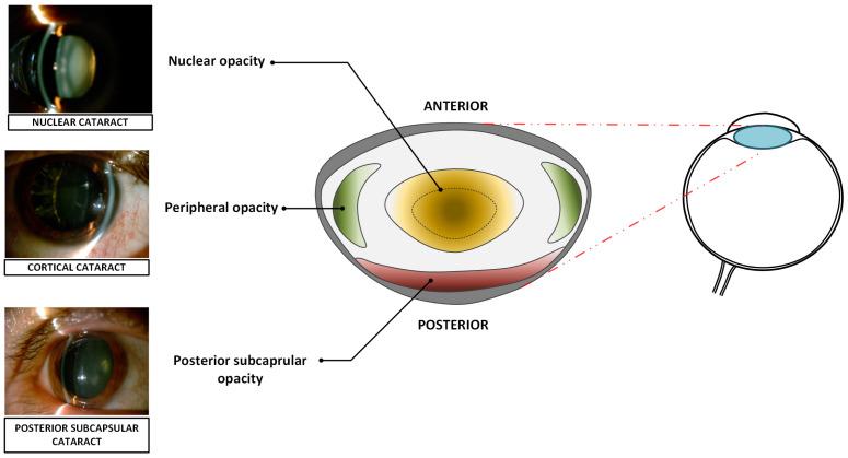 https://cdn.ncbi.nlm.nih.gov/pmc/blobs/69c4/12252290/e3890dc60f80/sensors-25-03954-g001.jpg