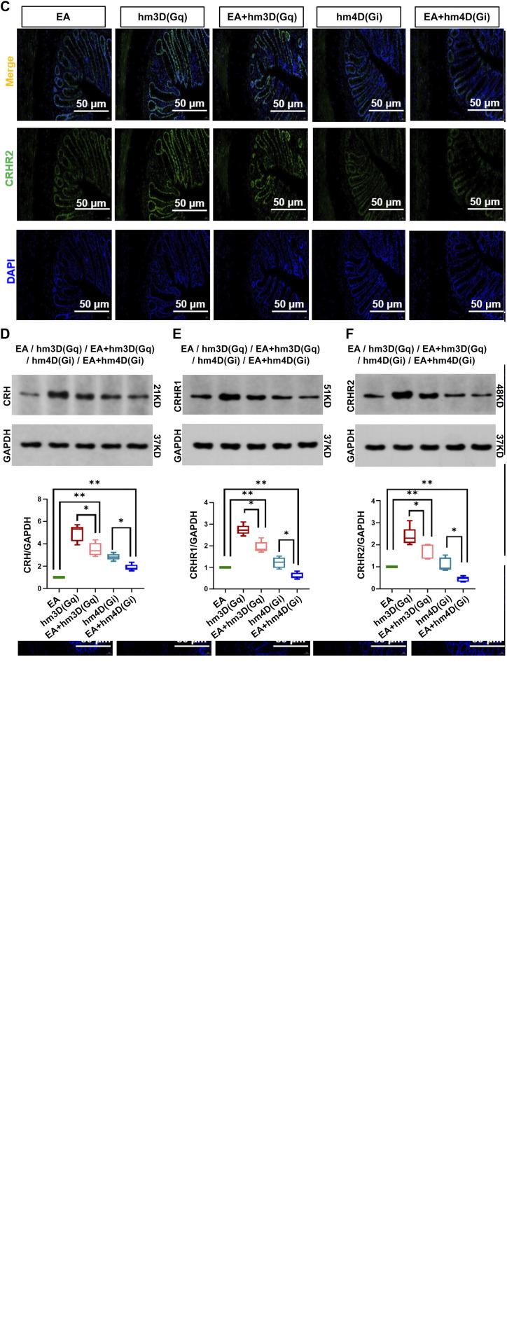 https://cdn.ncbi.nlm.nih.gov/pmc/blobs/69c6/10625839/d3d43bd1bc1c/jn.00156.2023_f006.jpg