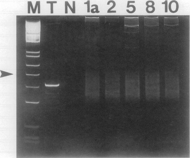 https://cdn.ncbi.nlm.nih.gov/pmc/blobs/69d0/1858098/08d9f2e29e02/amjpathol00023-0179-a.jpg