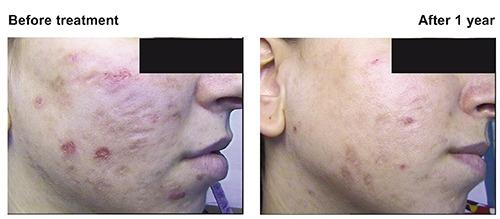 https://cdn.ncbi.nlm.nih.gov/pmc/blobs/69db/5475416/b76a10e84902/dr-9-1-7118-g005.jpg