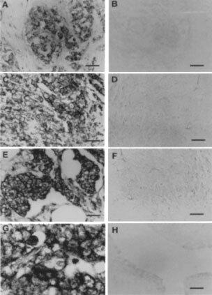 https://cdn.ncbi.nlm.nih.gov/pmc/blobs/69e4/2376136/e4c9689ac3ca/87-6600456f3.jpg