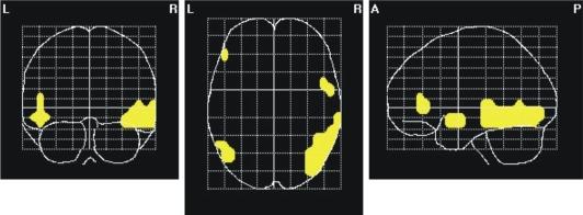 https://cdn.ncbi.nlm.nih.gov/pmc/blobs/69eb/2791035/2acce20596fb/fnhum-03-058-g008.jpg