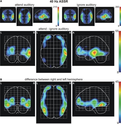 https://cdn.ncbi.nlm.nih.gov/pmc/blobs/69eb/2791035/5f632e0a2398/fnhum-03-058-g006.jpg