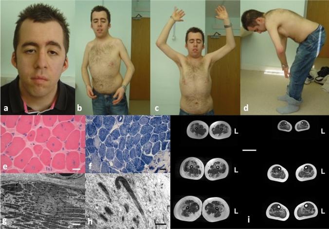 https://cdn.ncbi.nlm.nih.gov/pmc/blobs/69ef/7882473/d7878485158b/401_2020_2257_Fig1_HTML.jpg