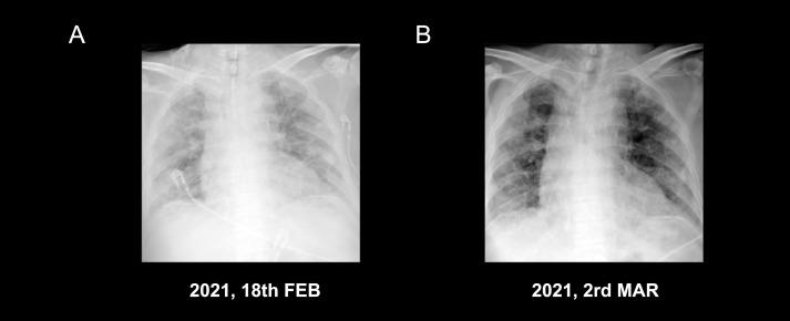 https://cdn.ncbi.nlm.nih.gov/pmc/blobs/69f3/9872202/44cb1785d248/fimmu-13-1072612-g004.jpg
