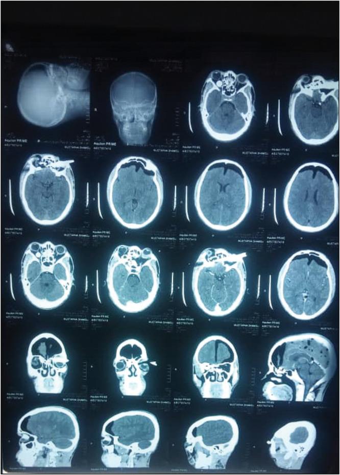 https://cdn.ncbi.nlm.nih.gov/pmc/blobs/69f4/12200785/d8d790ebc8cf/JWACS-15-362-g003.jpg