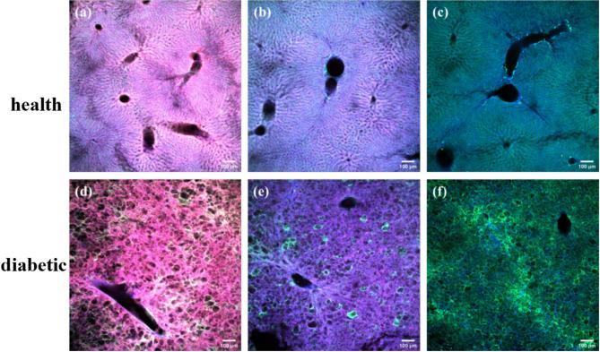 https://cdn.ncbi.nlm.nih.gov/pmc/blobs/69f5/11969017/23c22d7dbc5a/41598_2025_94479_Fig9_HTML.jpg