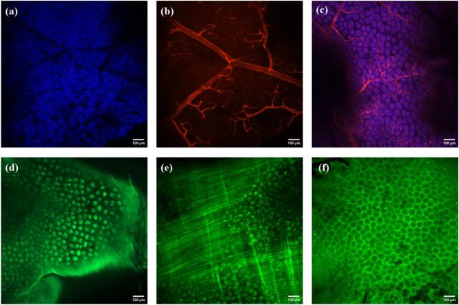 https://cdn.ncbi.nlm.nih.gov/pmc/blobs/69f5/11969017/f656416faa4e/41598_2025_94479_Fig4_HTML.jpg