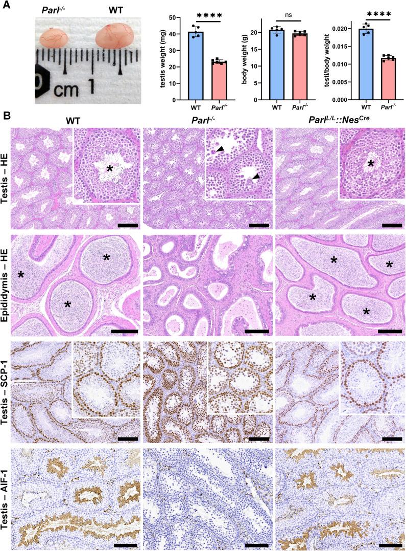 https://cdn.ncbi.nlm.nih.gov/pmc/blobs/69f6/10519710/b199be2bb91b/elife-84710-fig1.jpg