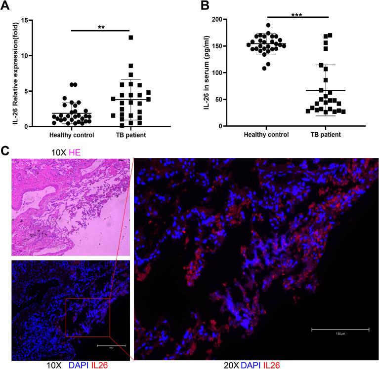 https://cdn.ncbi.nlm.nih.gov/pmc/blobs/69fb/11486762/56cec8537dee/fcimb-14-1455819-g001.jpg