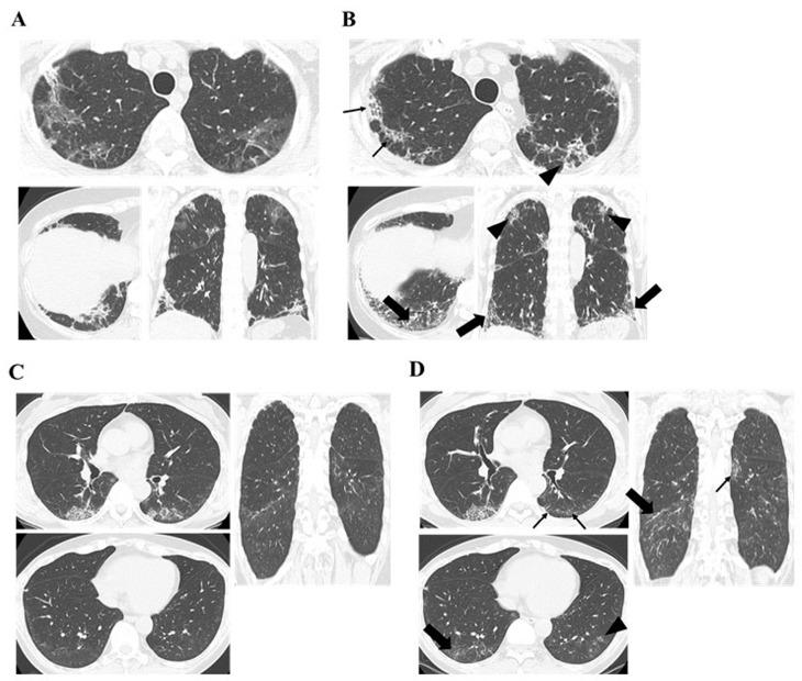 https://cdn.ncbi.nlm.nih.gov/pmc/blobs/6a05/11900237/a6e2d6ef3e16/jcm-14-01601-g002.jpg