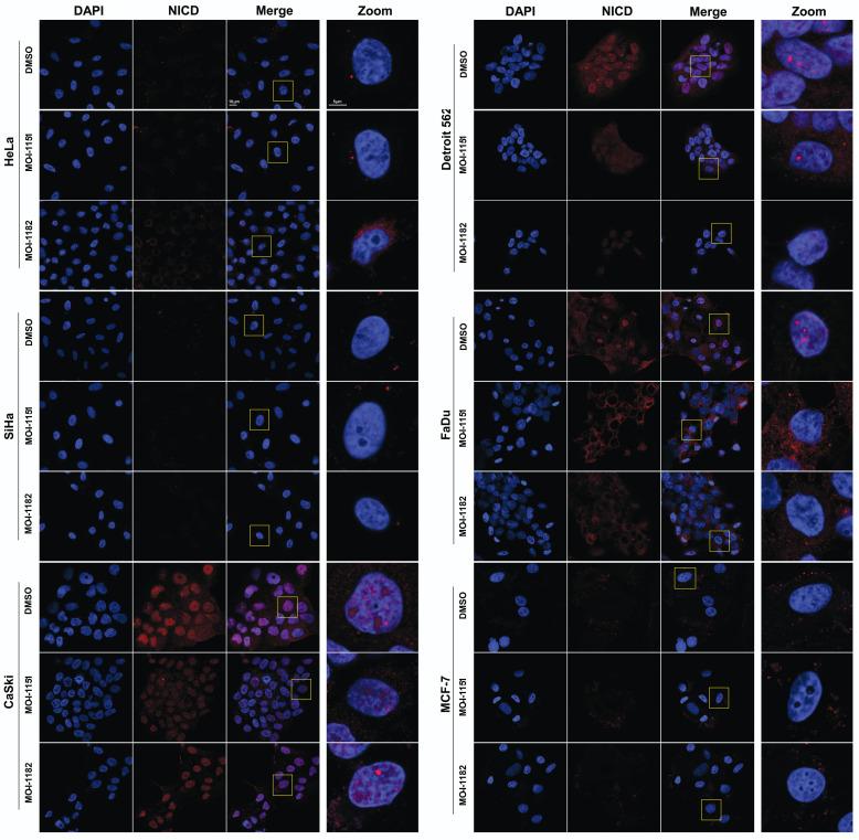 https://cdn.ncbi.nlm.nih.gov/pmc/blobs/6a0e/11134442/880e18b81ab9/jcav15p3466g005.jpg