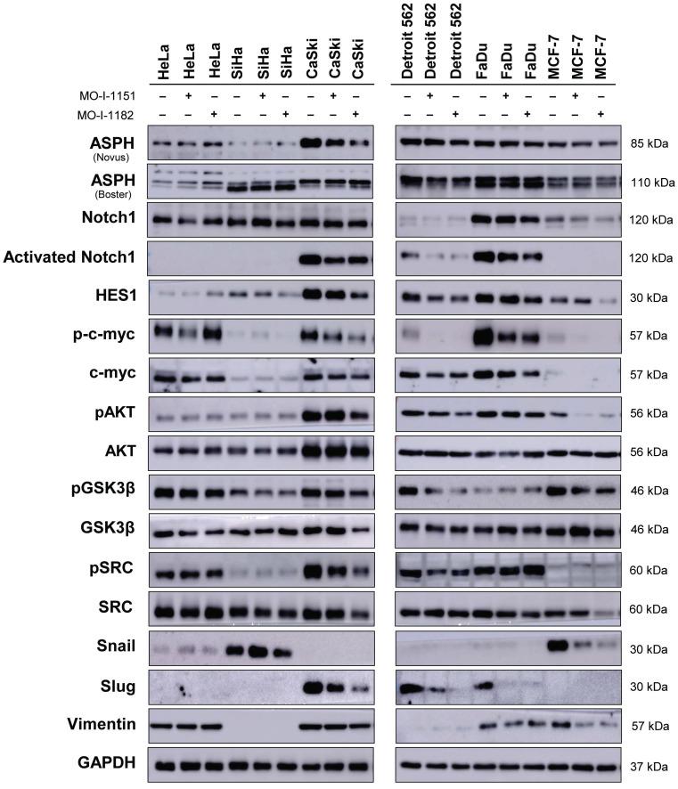 https://cdn.ncbi.nlm.nih.gov/pmc/blobs/6a0e/11134442/f4577028e5bd/jcav15p3466g004.jpg