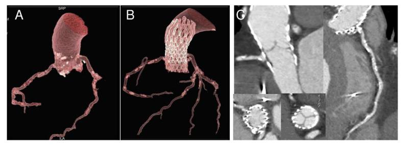 https://cdn.ncbi.nlm.nih.gov/pmc/blobs/6a0e/7712517/8b89e4794b87/bioengineering-07-00121-g003.jpg
