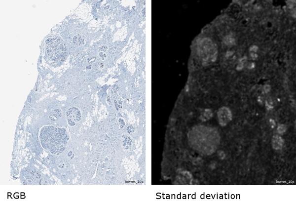 https://cdn.ncbi.nlm.nih.gov/pmc/blobs/6a0f/4305969/ee6b5b8749ae/1746-1596-9-S1-S11-2.jpg
