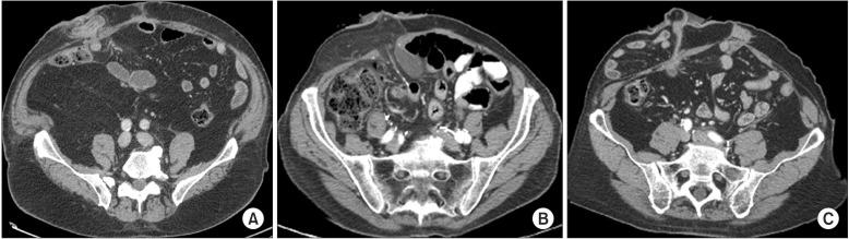 https://cdn.ncbi.nlm.nih.gov/pmc/blobs/6a1b/4949695/9d20420ed344/icu-57-240-g001.jpg