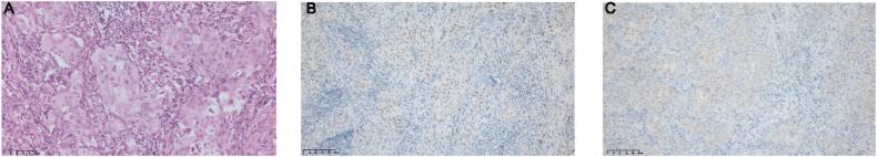 https://cdn.ncbi.nlm.nih.gov/pmc/blobs/6a1c/11489313/9e65cd6e4870/gr2.jpg